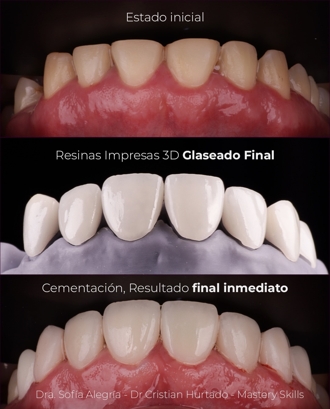 Resinas impresas en 3D antes y después