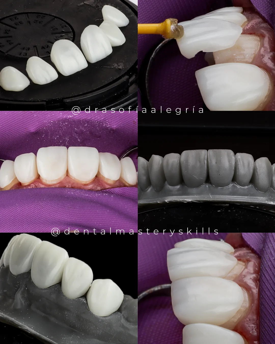 Casos del centro de formación Dental Mastery Skills
