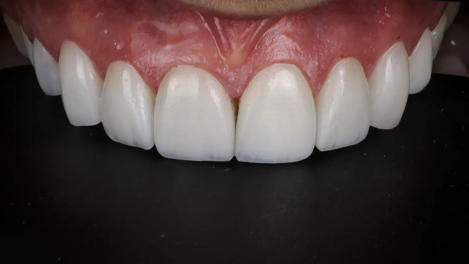 Sonrisa con encías sanas