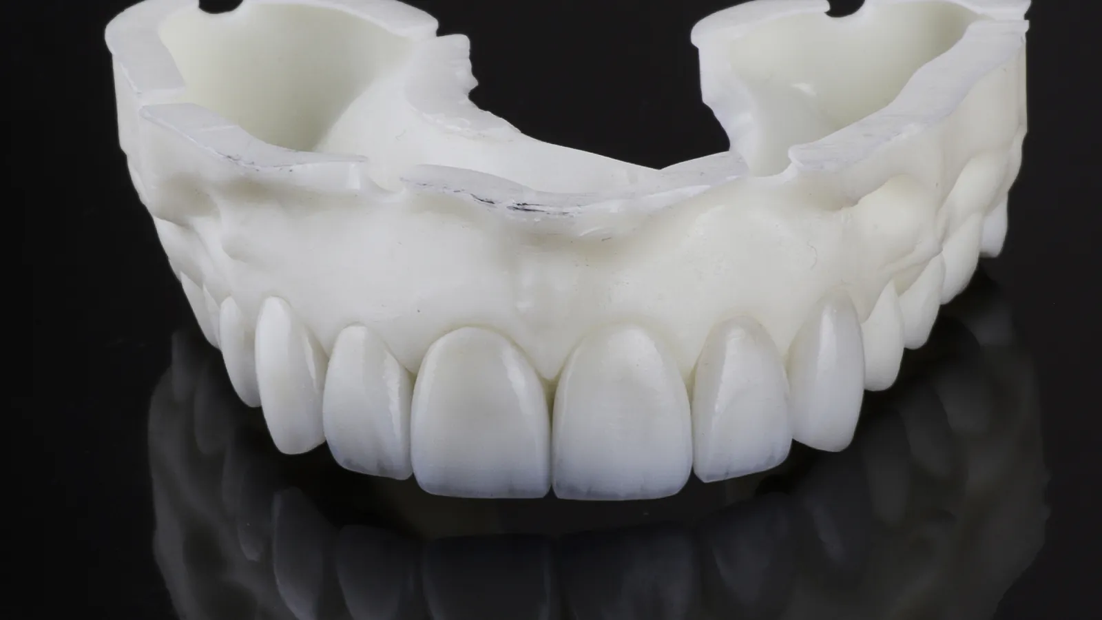 Prótesis de arcada completa impresa en 3D