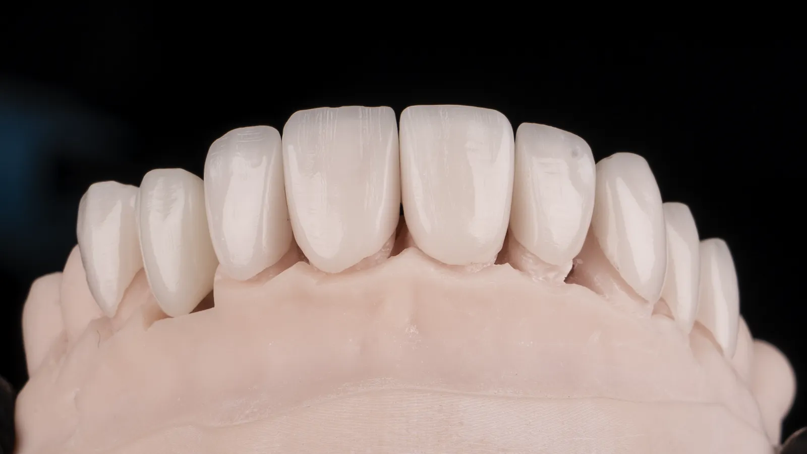 Modelo de trabajo para rehabilitación oral