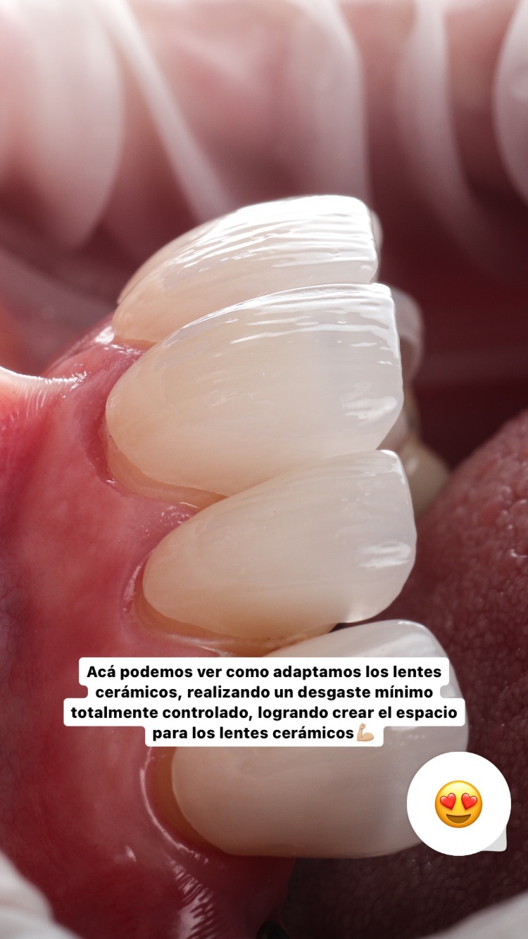 3 · Adaptación mínima
